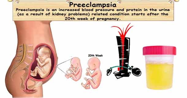 Swollen lady parts during pregnancy