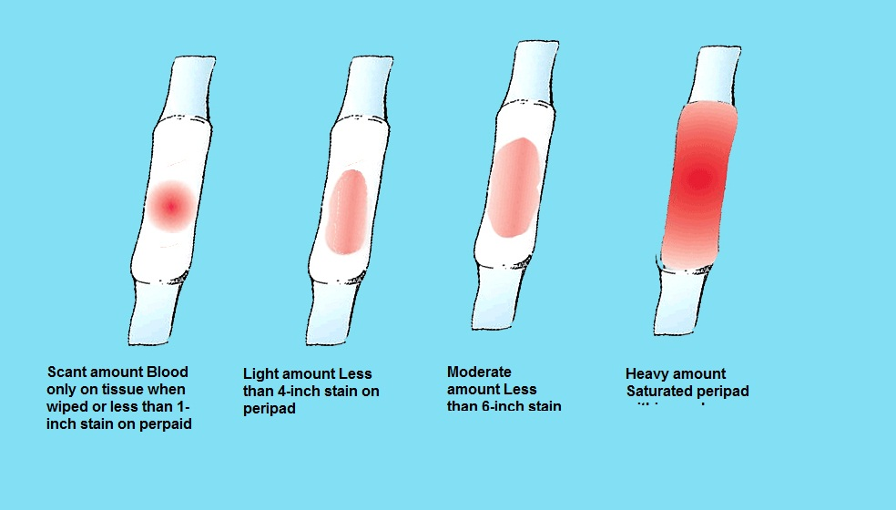 How long does a woman bleed after miscarriage