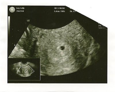 How early can you get ultrasound for pregnancy
