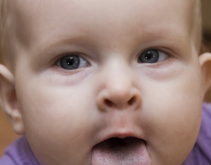 White blister on baby tongue