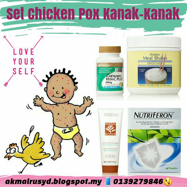 Mild chicken pox in toddlers