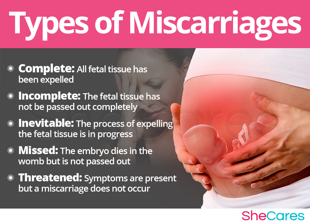 Does bleeding always mean miscarriage