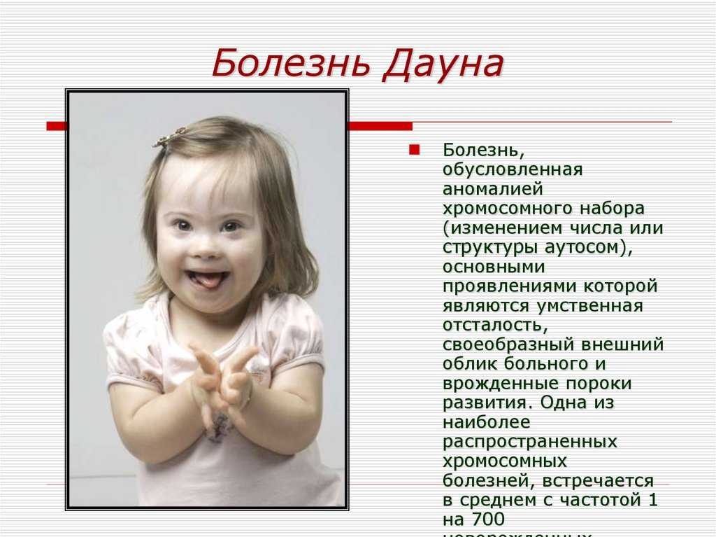 Non invasive testing for down syndrome