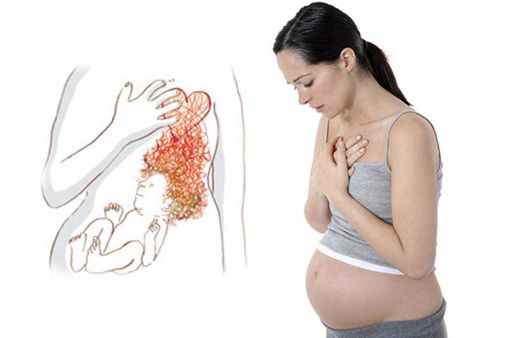 Pregnancy symptom thirsty