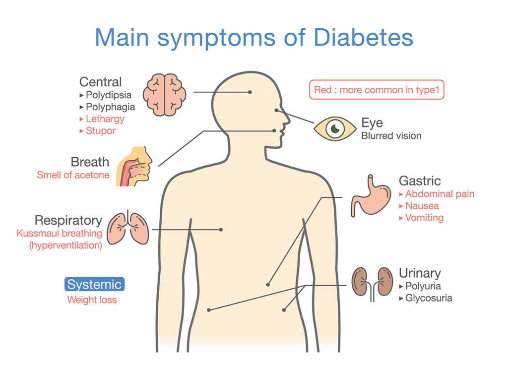 What is the symptoms of jaundice