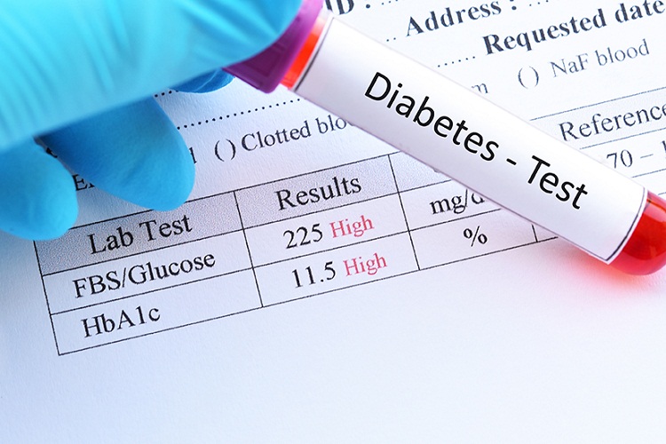 Blood test on newborns