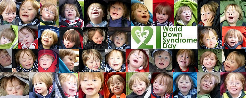 Down's syndrome screening results