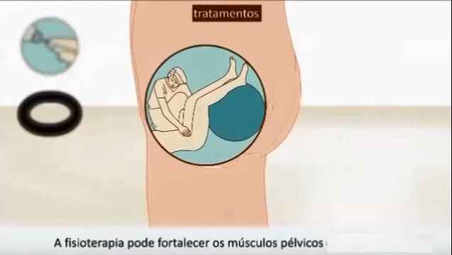Pelvic floor muscles pregnancy