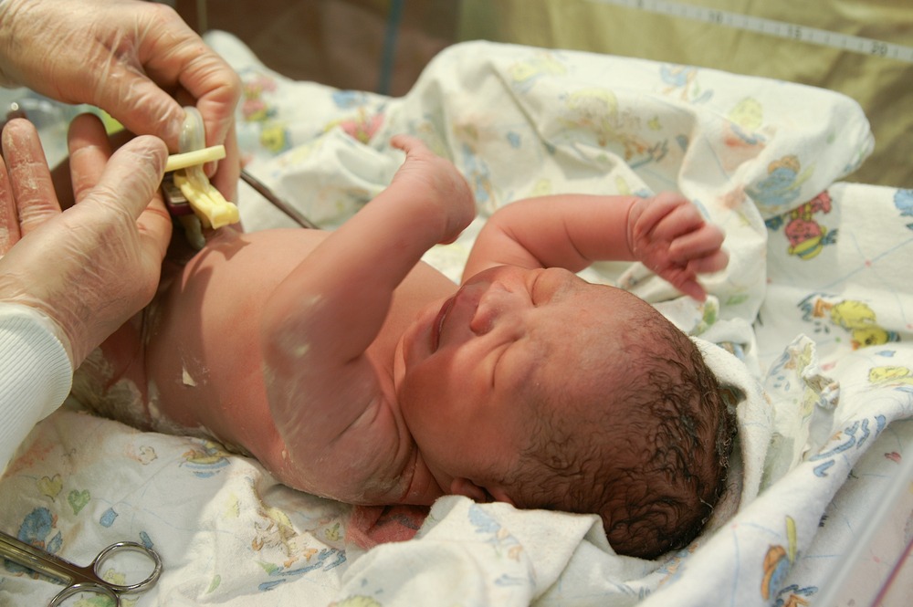 How to care umbilical cord of a newborn