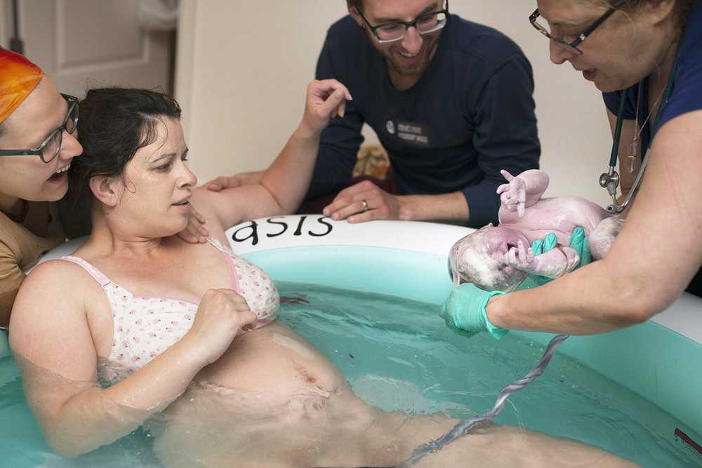 Birth of baby by operation