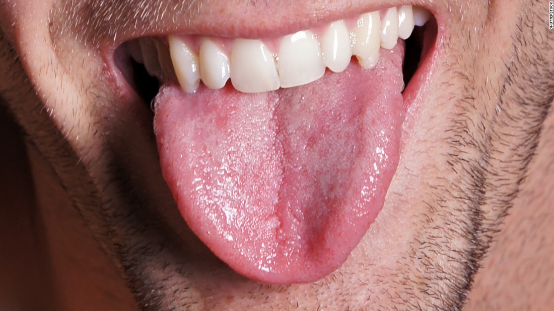 Red bumps on baby tongue