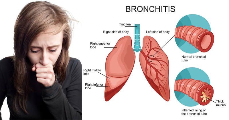 How long is a child contagious with fifth disease