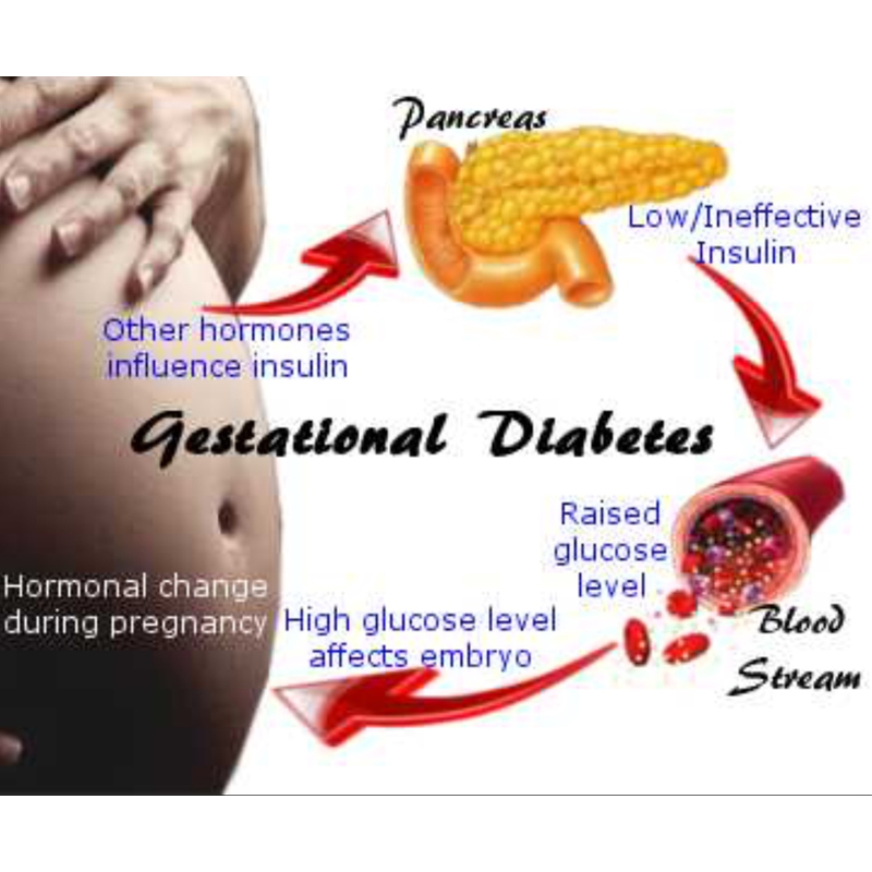 Pregnancy normal sugar levels