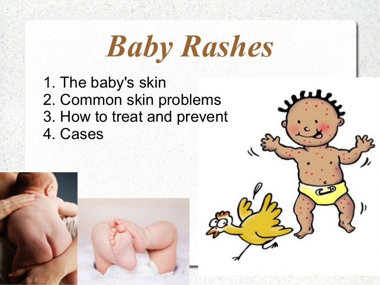 When to worry about rashes on babies