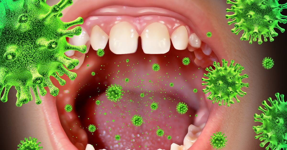 Mouth infections in babies