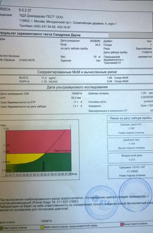 12 week test for down syndrome