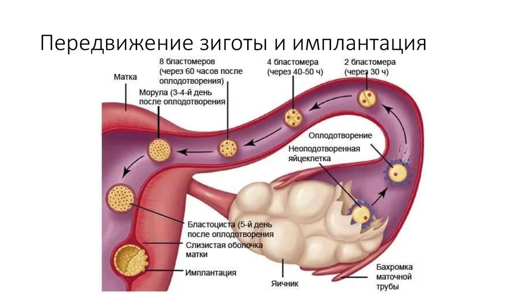 Ectopic pregnancy implantation