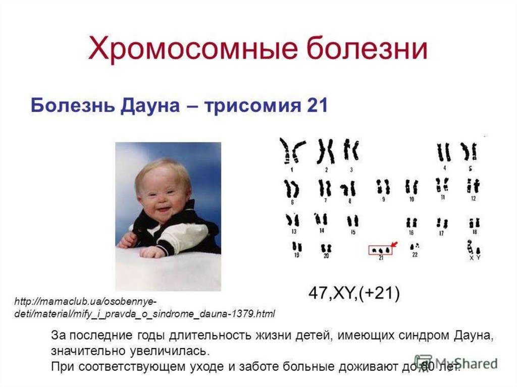 Triple test for down syndrome