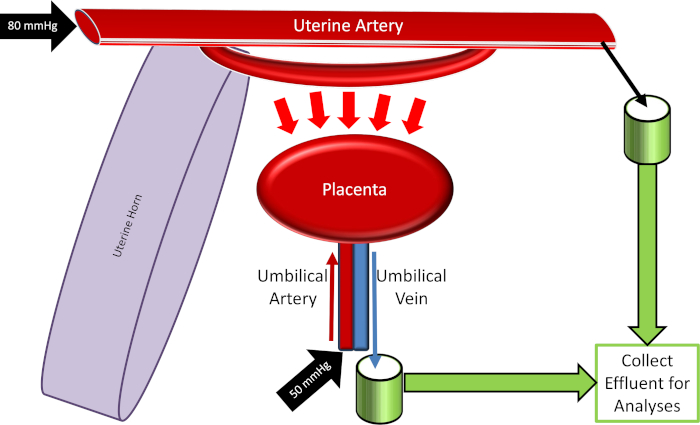 Poor placental perfusion