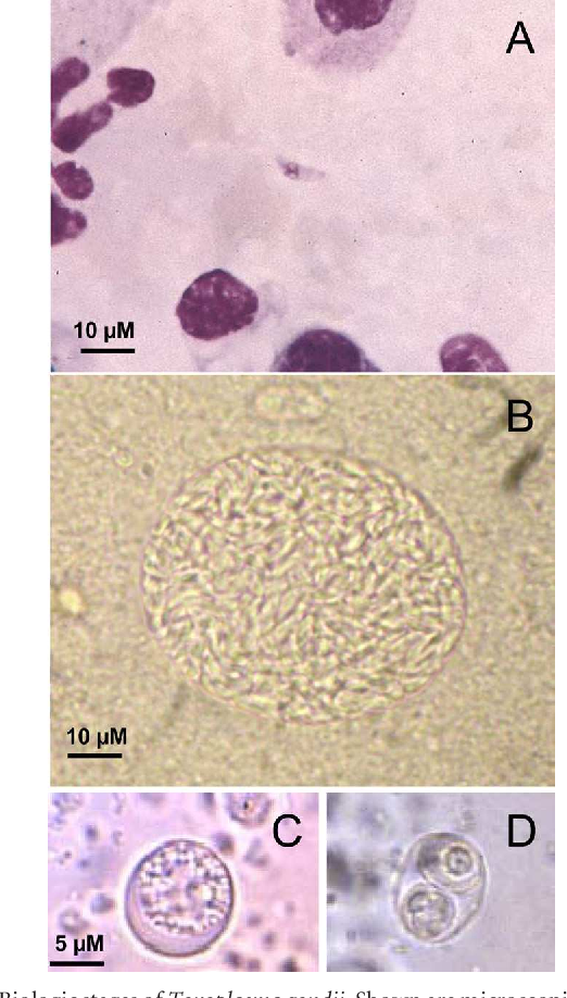 Toxoplasmosis third trimester