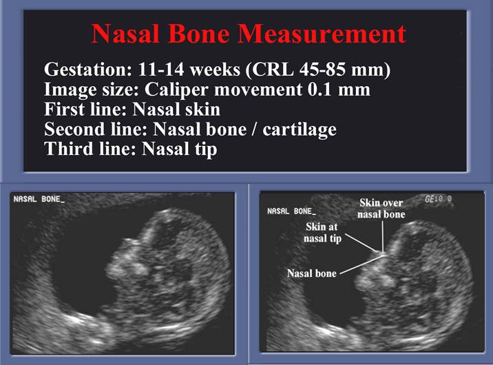 First ultrasound how many weeks