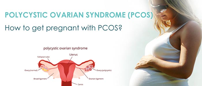 Polycystic ovarian syndrome pregnancy complications