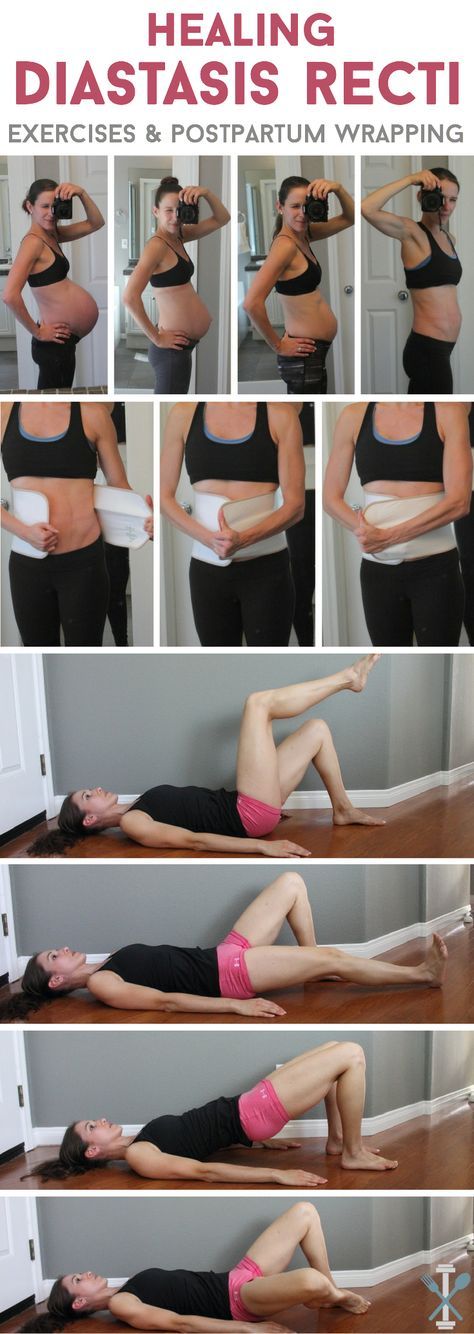 Postpartum c section exercises