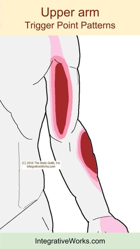 Ectopic shoulder tip pain