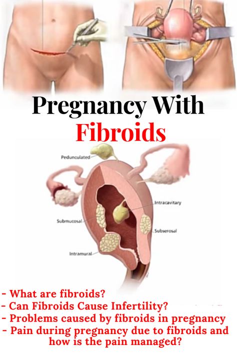 Stages of cervix during pregnancy