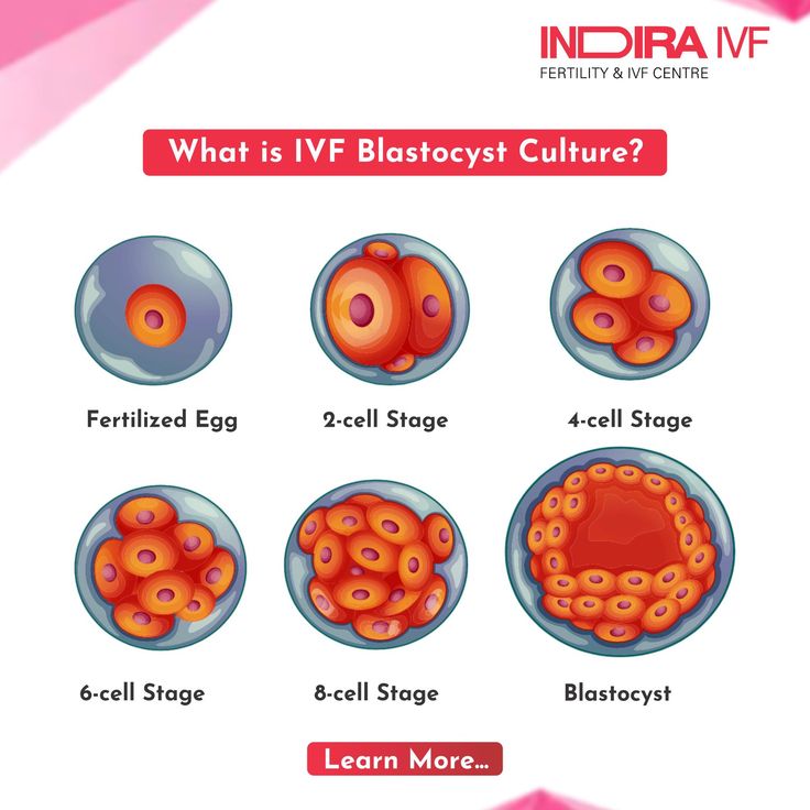 Ivf how does it work