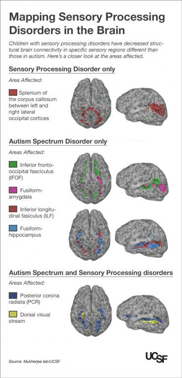 How to engage a child with autism