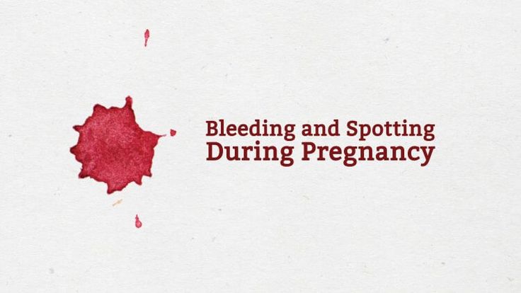 What does it mean when your pregnant and you start bleeding