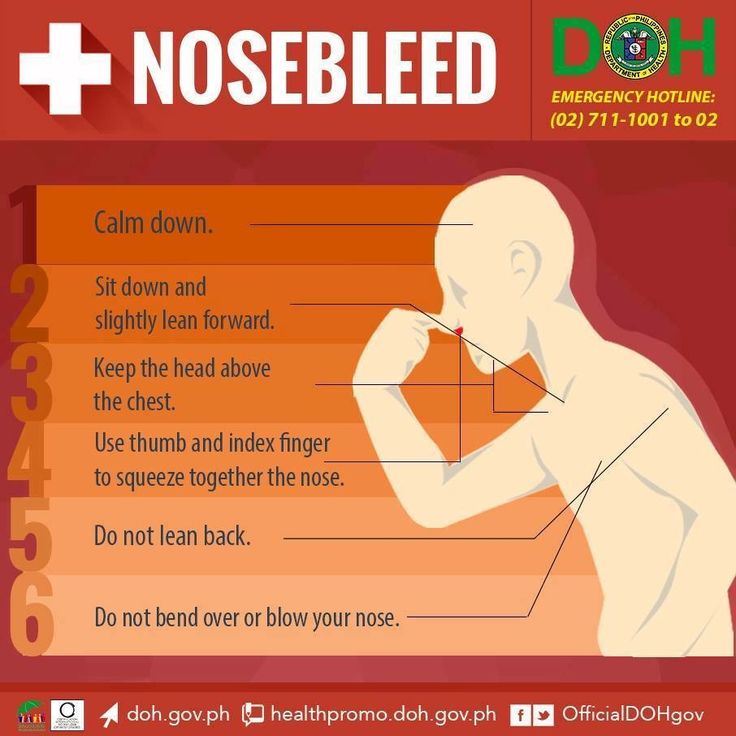 Signs of nose bleed