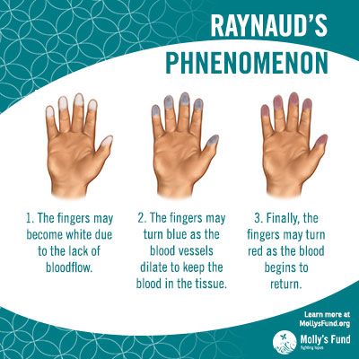 Numbness in fingertips after pregnancy