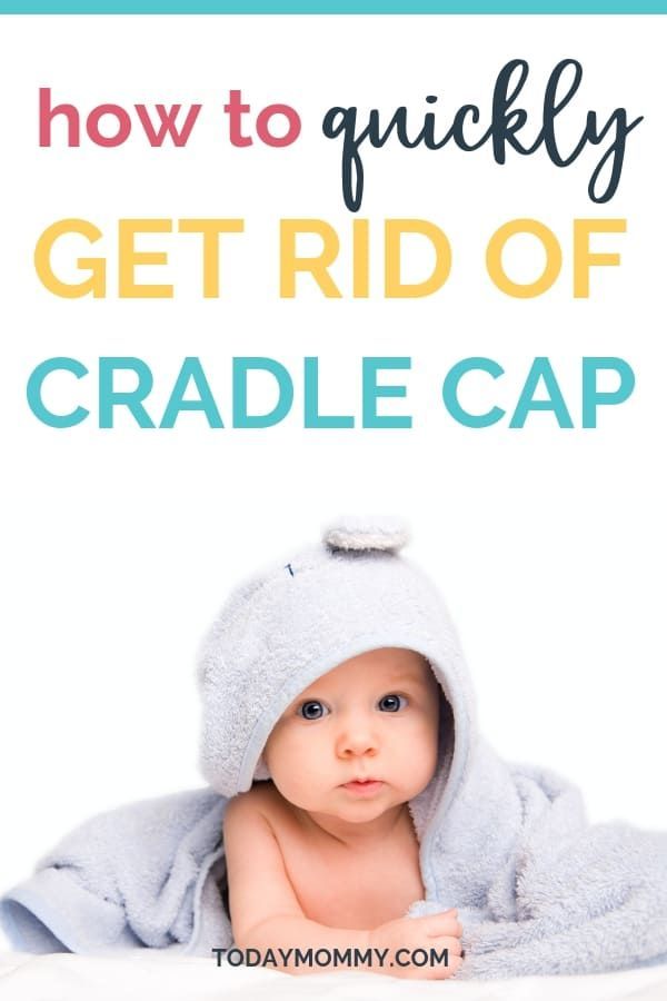 Beginning of cradle cap