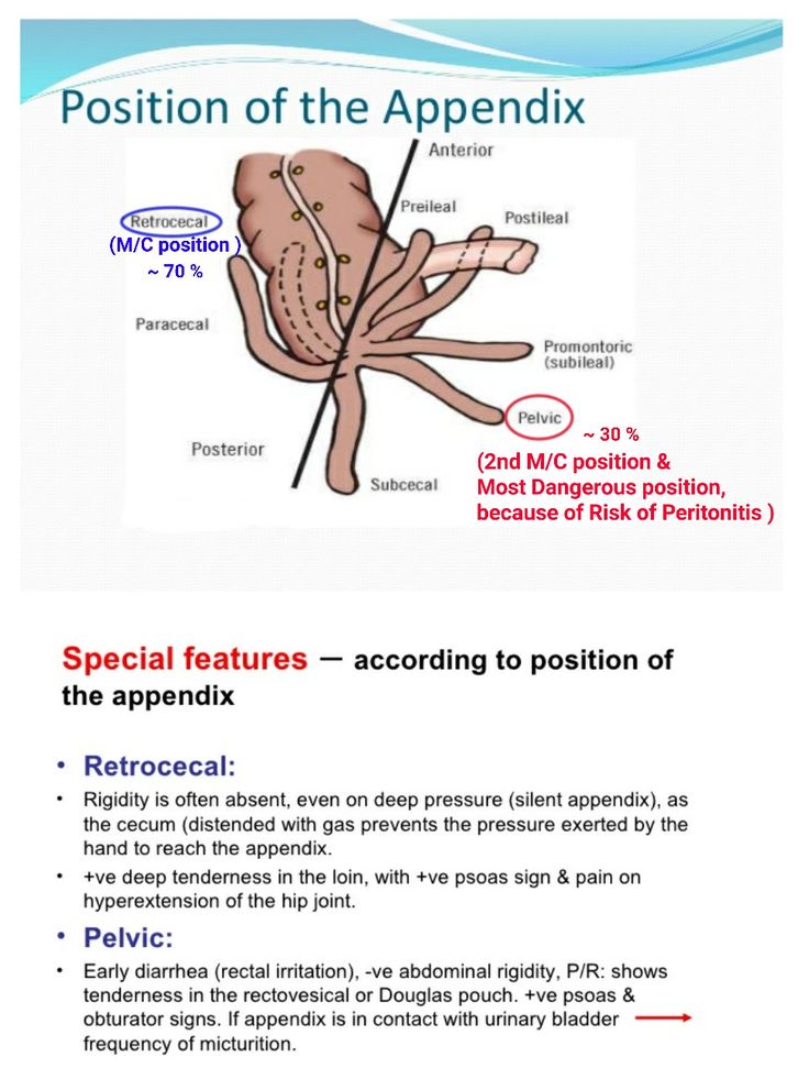 Posterior pelvic pain