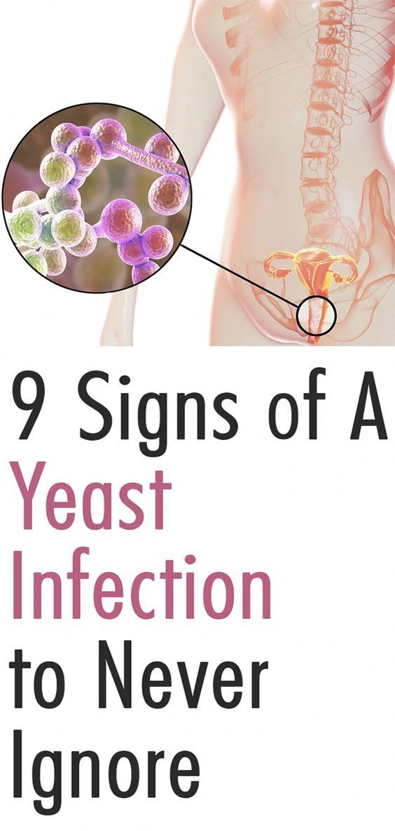 What helps with yeast infection while pregnant
