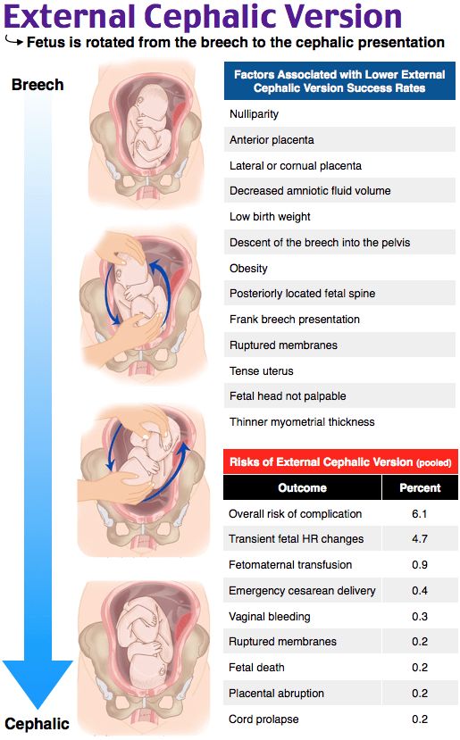 Fetal distress complications