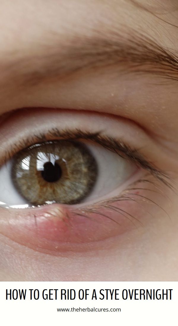 How to tell what color eyes your child will have