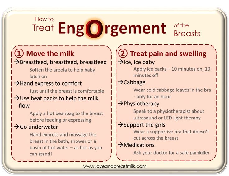 How to relieve engorgement when not breastfeeding
