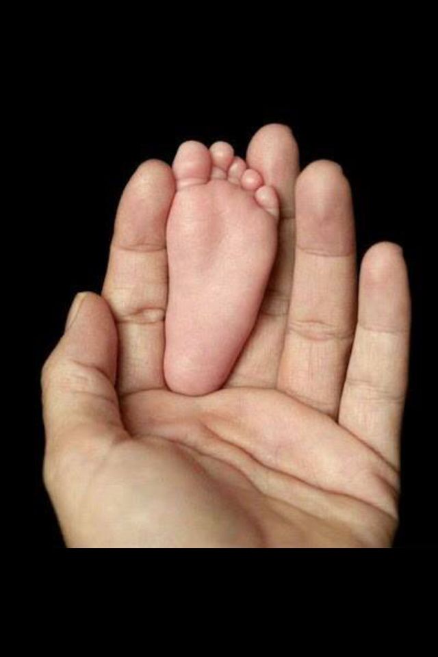 Bright red hands and feet in babies