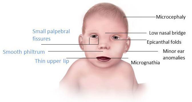 Red spots on infants face