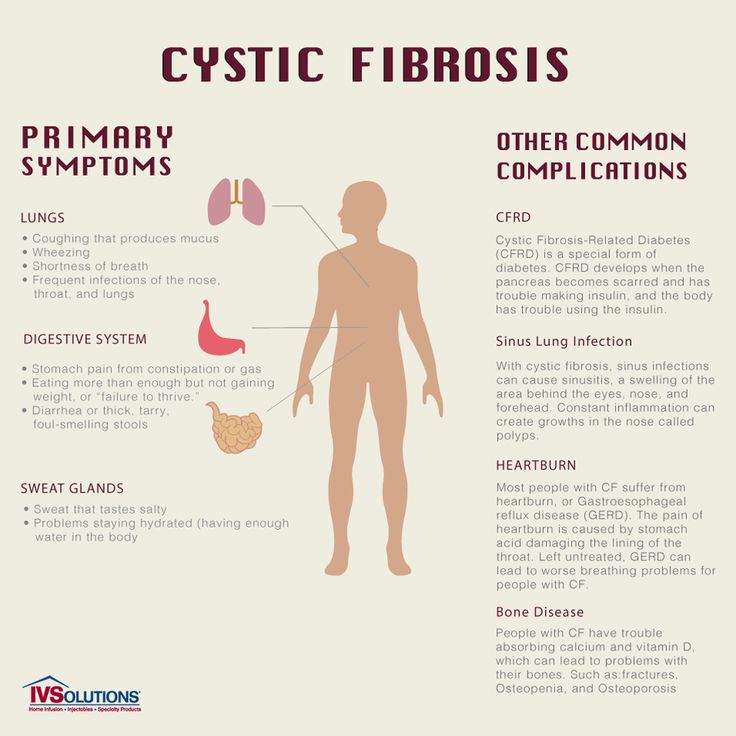 Cystic fibrosis and infants