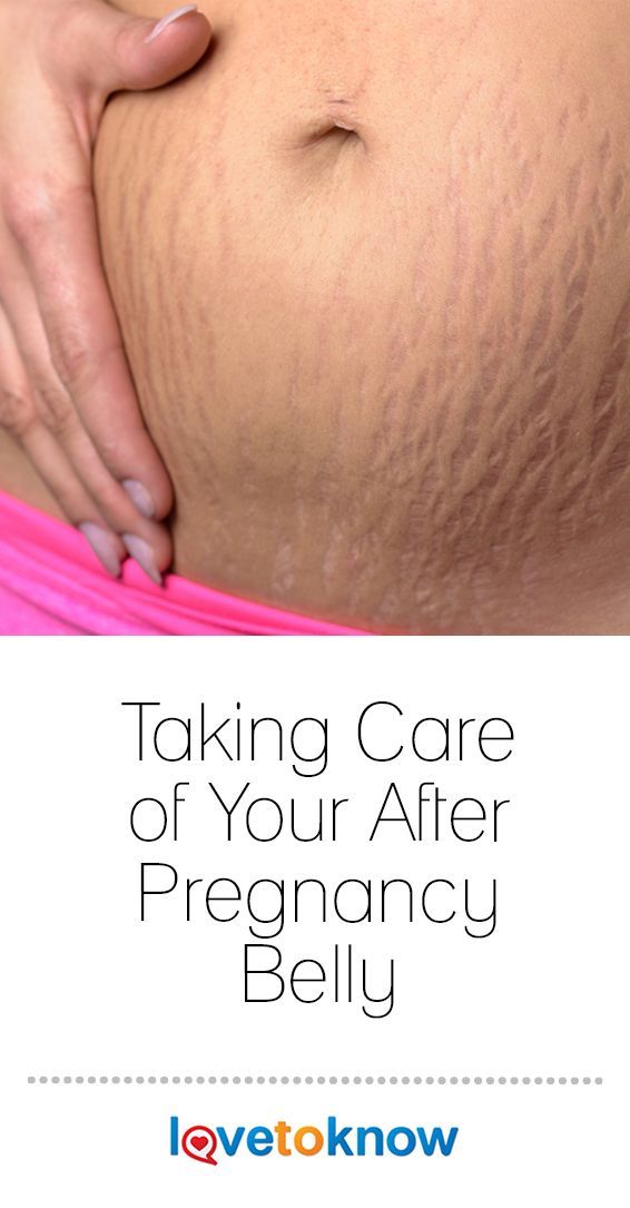 When do you get stretch marks during pregnancy