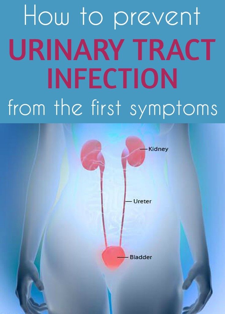 Urine infections in babies