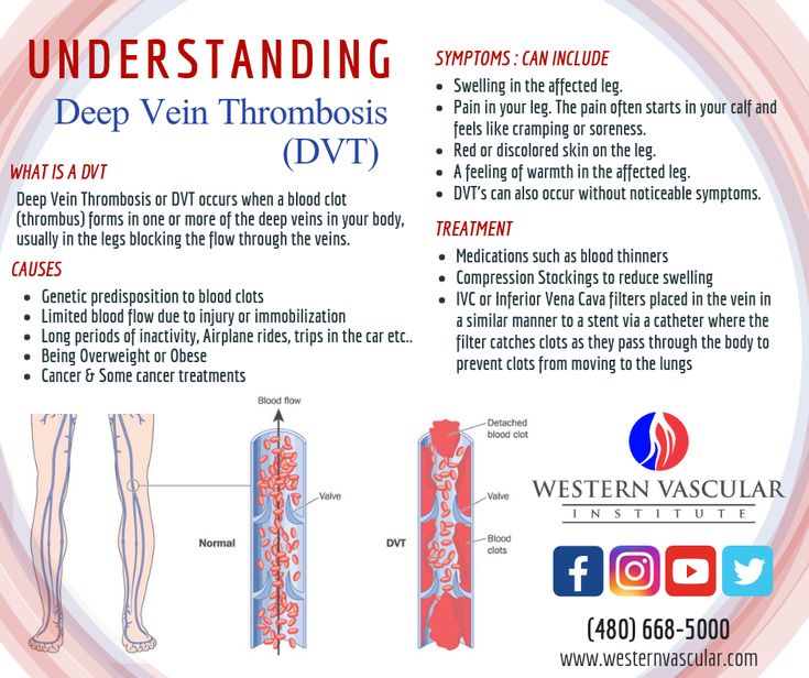 Are blood clots a sign of miscarriage