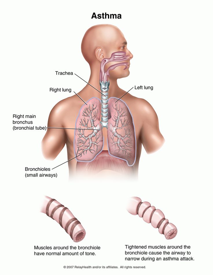 Asthma symptoms pregnancy