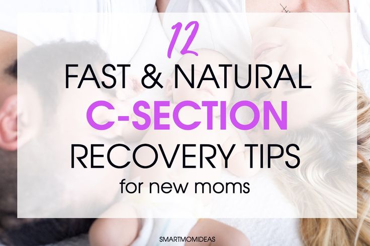 Emergency c section recovery