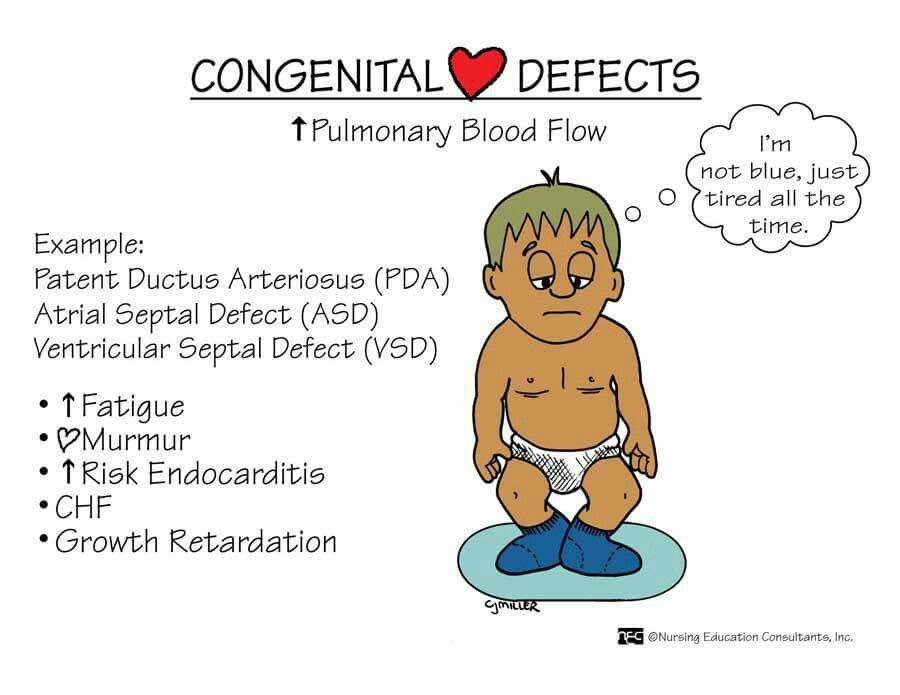 What is a congenital