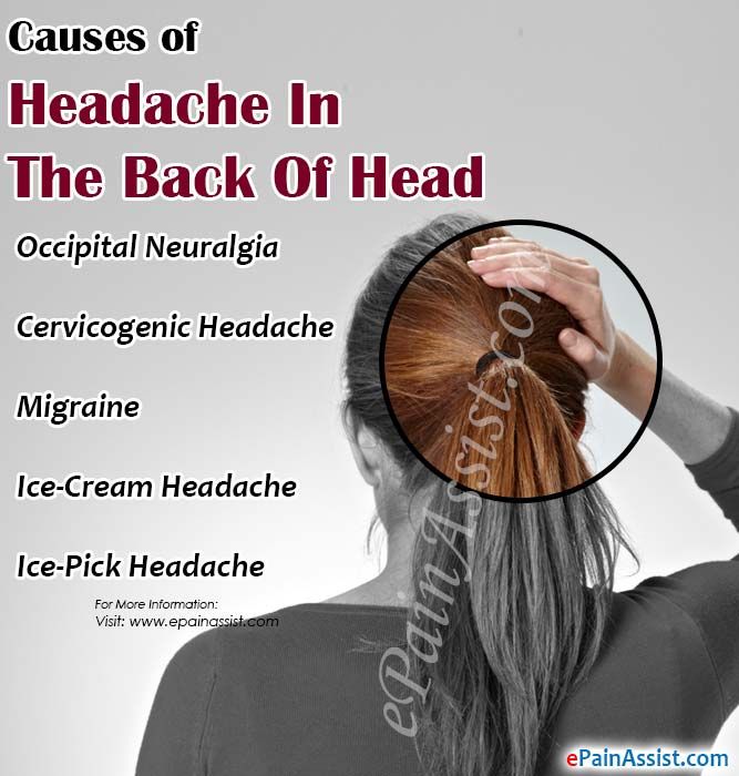 Headache in back of head pregnant